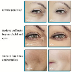 Facial Ice Roller & Globes Set for Puffiness & Dark Circles