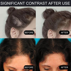 Hairline Coverage Touch Up Powder Portable Easy To Apply Hairline Concealer