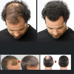100ml Dense Hair Shampoo Repairs Hair Care Shampoo