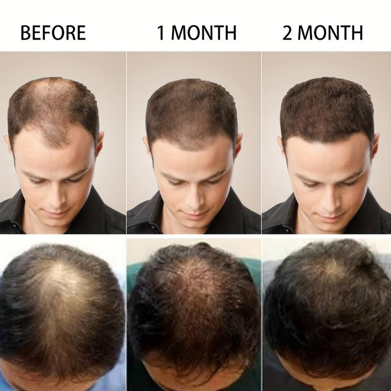 50g Biotin & Collagen Hair Cream Strengthens Roots Revitalizes Hair Health