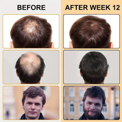 Ginger Hair Care Cream - Strengthen, Thicken, Lengthen - Daily Use