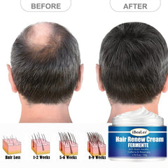 Biotin Keratin Hair Renew Cream - Hair Care Essential