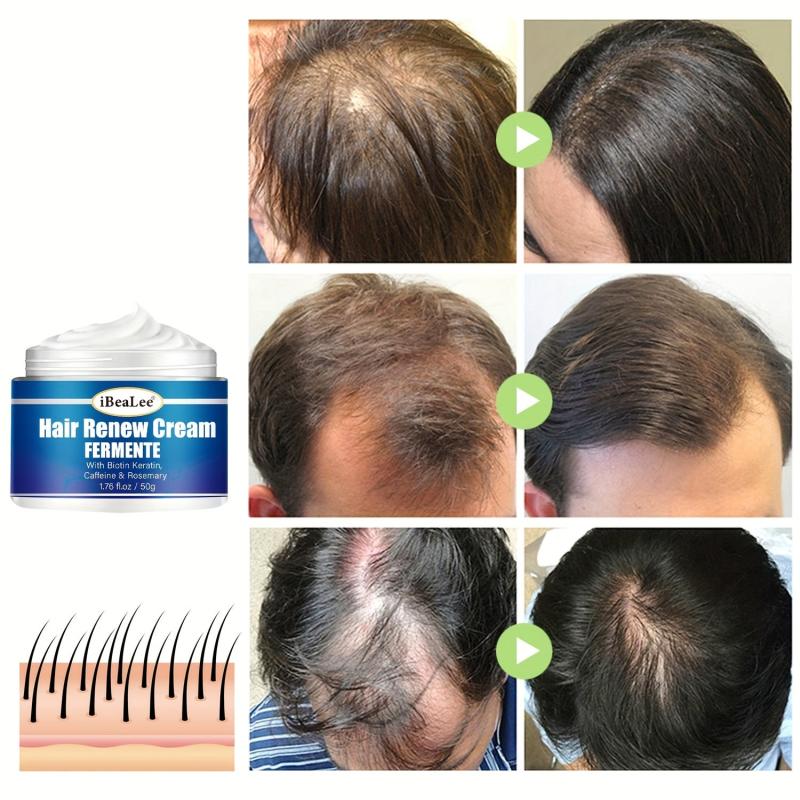 Biotin Keratin Hair Renew Cream - Hair Care Essential