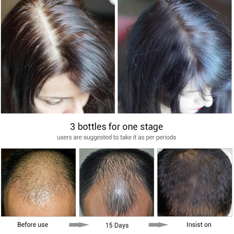 Biotin Hair Cream for Stronger Hair