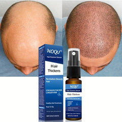 25ml Hair Care Spray Revitalizes Thin Hair for Men & Women
