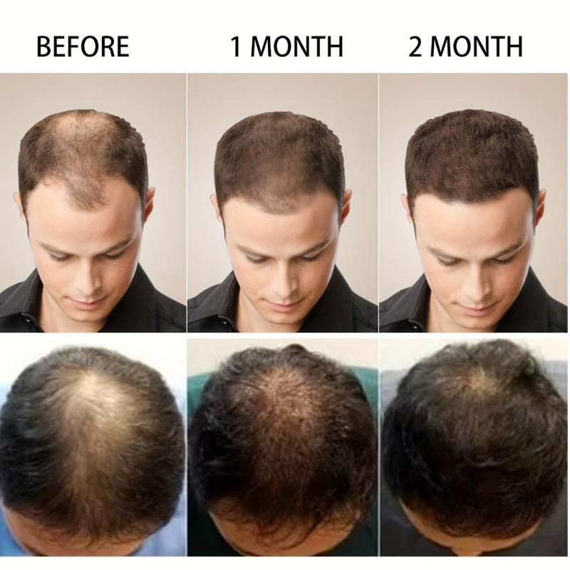 Biotin Hair Strengthening Cream for Split Ends