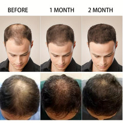 Biotin Hair Strengthening Cream for Split Ends