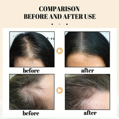 Rice Shampoo Soap - Moisturizes, Cleanses, Repairs, Strengthens