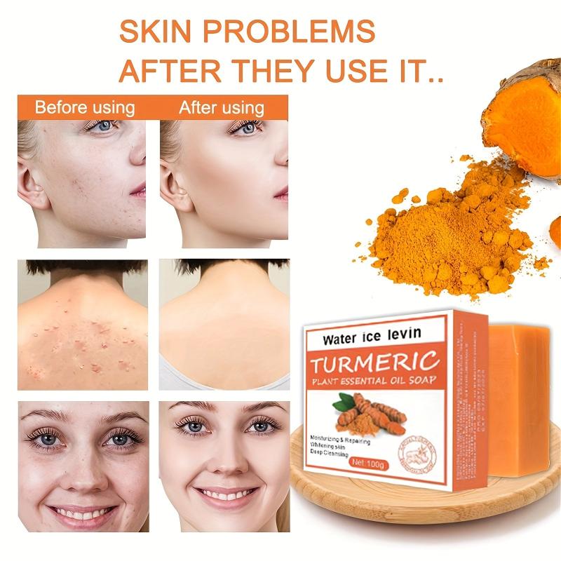 Turmeric Plant Essential Soap Ginger Shampoo Deep Cleaning Hair