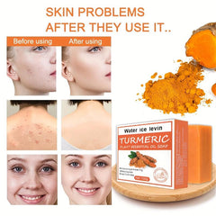 Turmeric Plant Essential Soap Ginger Shampoo Deep Cleaning Hair