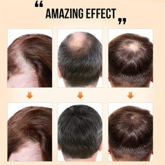 Biotin Hair Care Cream for Fast Healthy Hair Growth