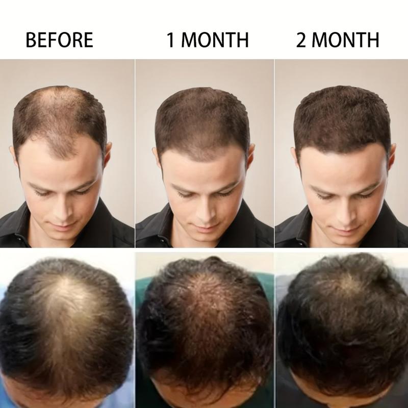 50g Scalp Spot Cream Daily Hair Care Cream For Women Men