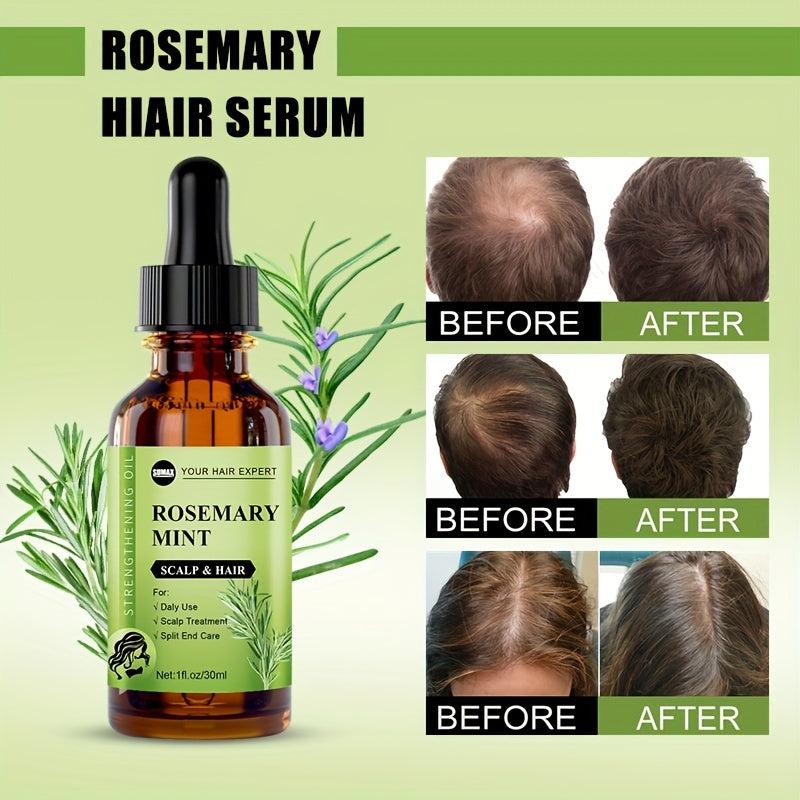 30ml Rosemary Mint Hair Essential for All Hair Types