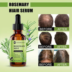 30ml Rosemary Mint Hair Essential for All Hair Types