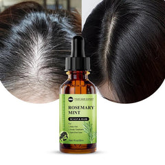 30ml Rosemary Mint Hair Essential for All Hair Types