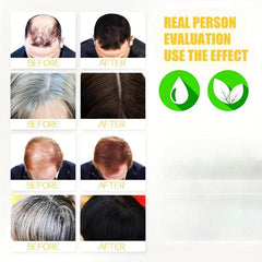 10pcs Herbal Hair Care Shampoo Bags Ginger Extract All Hair Types