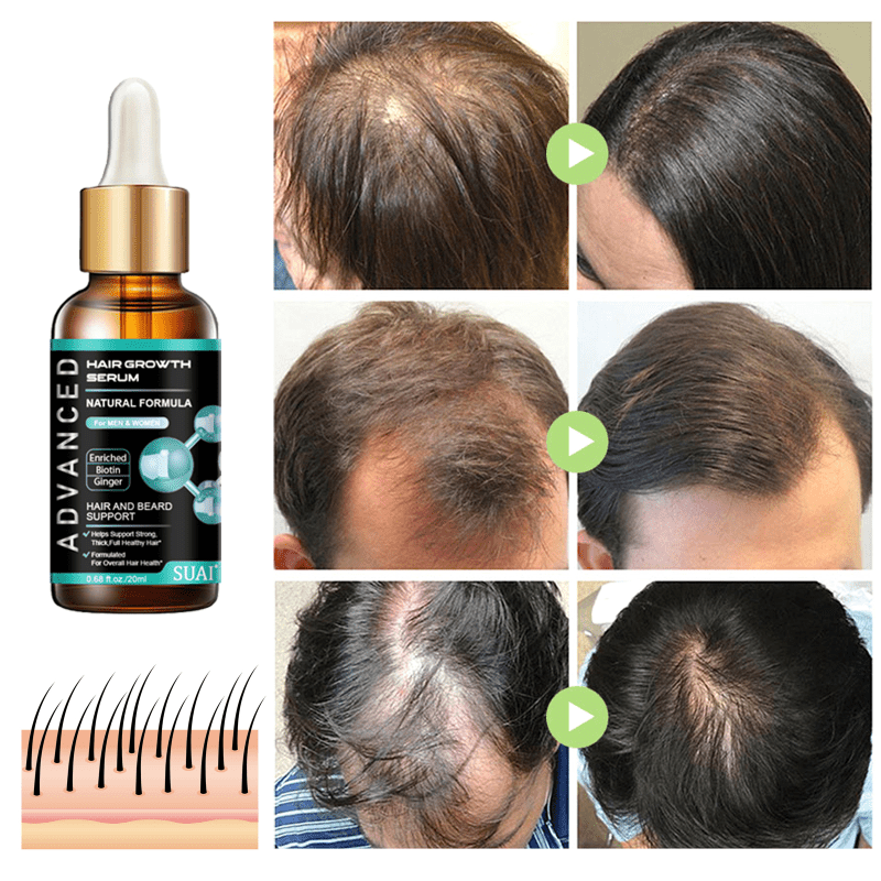 Ginger Hair Care Vitamins Natural Hair Serum for Thicker Healthier Hair