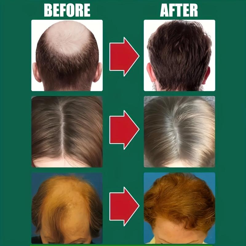 Dense Hair Cream For All Hair Types - Repairs Damaged Hair