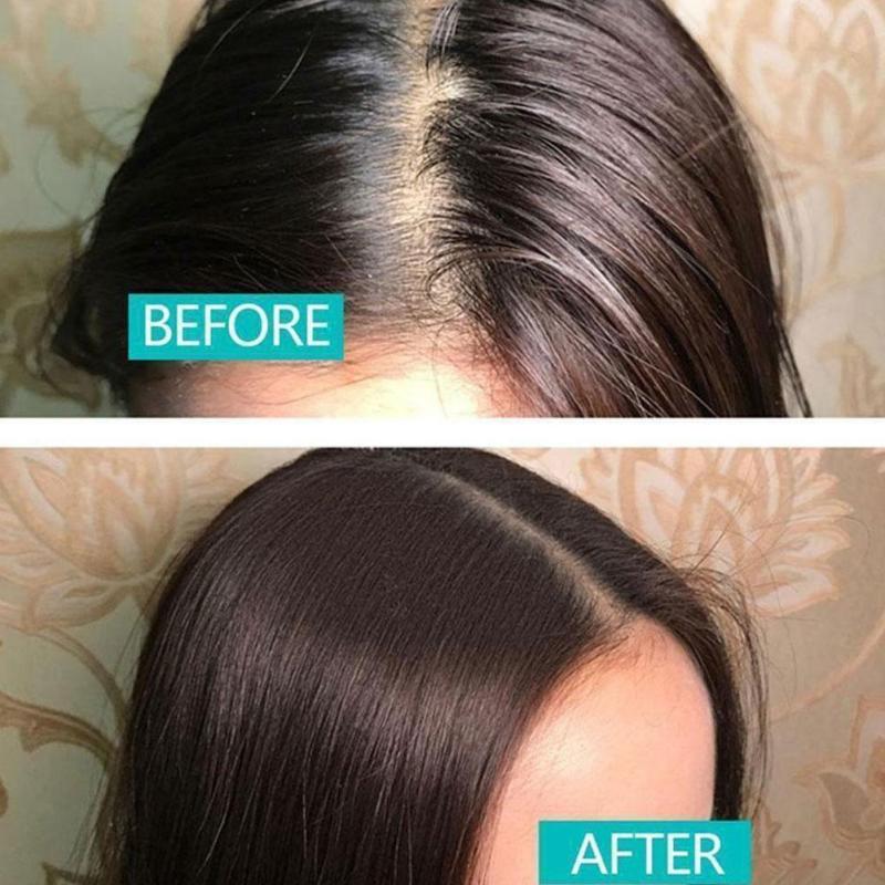 10g Hair Mattifying Powder Volumizing Hair Powder For Men And Women