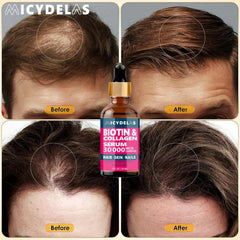 30ml Biotin Collagen Serum: Healthy Hair Root to Tip