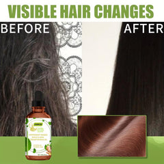 Ginger Mint Hair Care Essential Scalp Massage Care