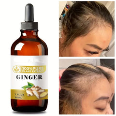 Ginger Plant Extract Hair Care Essential Serum
