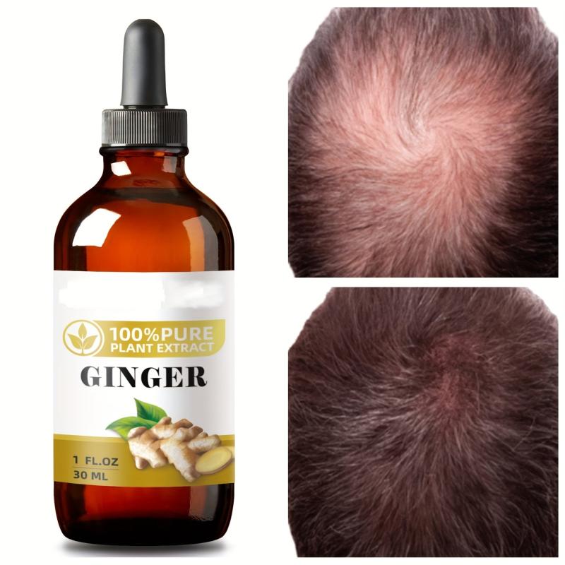 Ginger Plant Extract Hair Care Essential Serum