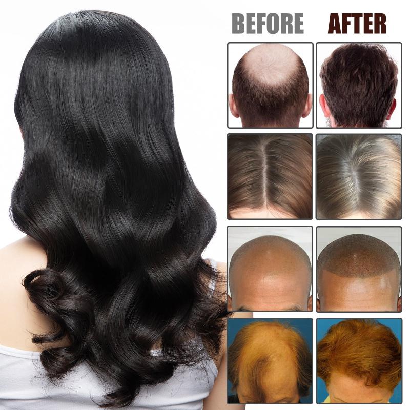 Hair Generating Serum Dense Hair Care Essential Hair And Scalp Care