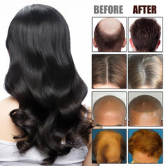Hair Generating Serum Dense Hair Care Essential Hair And Scalp Care