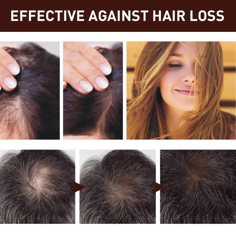 Hair Generating Serum Dense Hair Care Essential Hair And Scalp Care