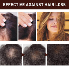 Hair Generating Serum Dense Hair Care Essential Hair And Scalp Care