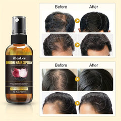 30ml Onion Hair Spray Strengthens Hair Roots Healthy Hair Care Essential