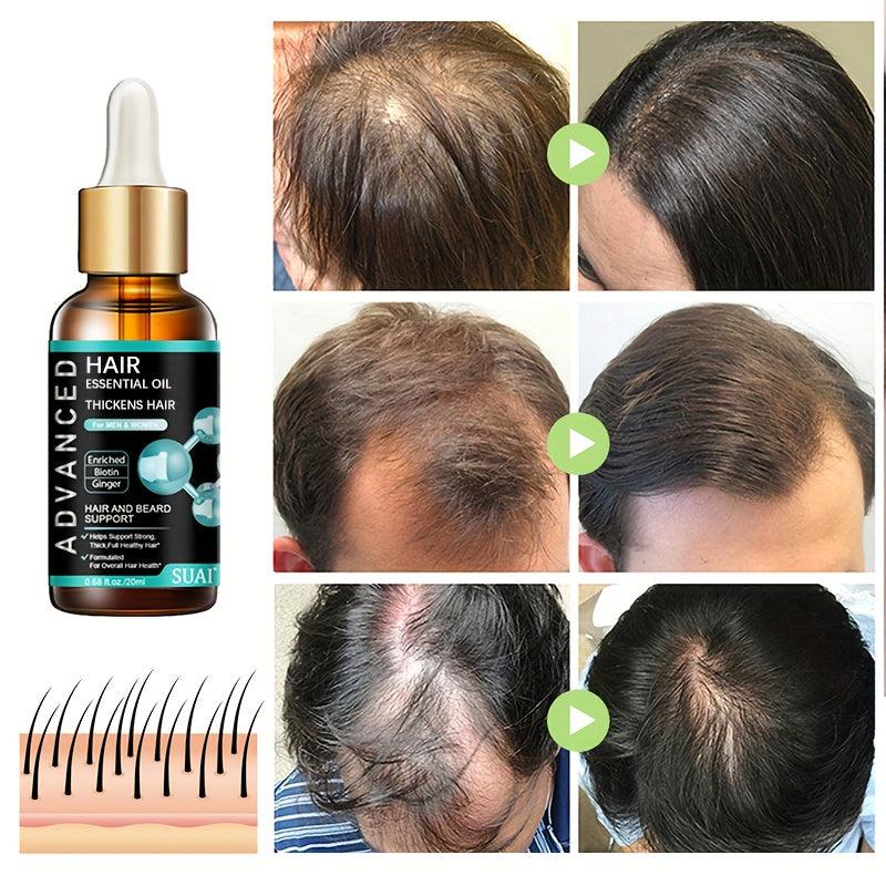Ginger Hair Essential for All Hair Types Natural Beauty Hair Care Product