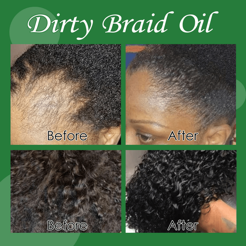 50ml Dirty Braid Scalp Hair Care Reduce Shedding Repair Hair And Moisture