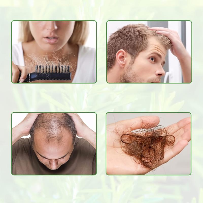 20ml Rosemary Mint Hair Serum Ginger Hair Care Men Women