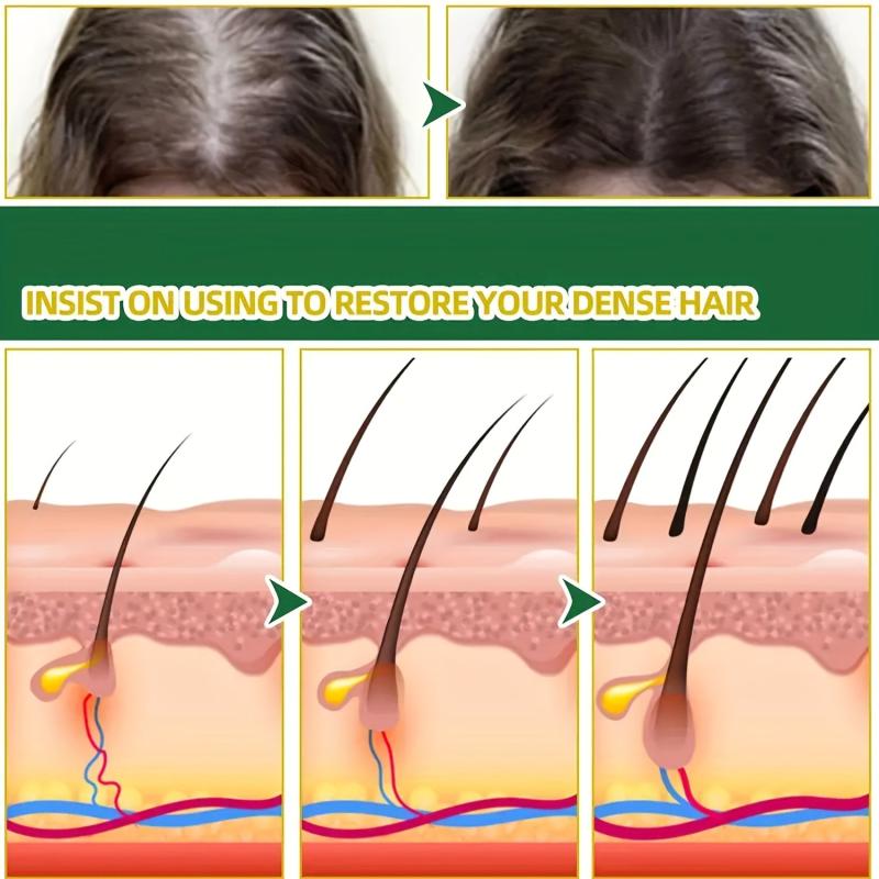 Onion Essence Hair Spray 7 Days Hair Essential Onion Hair Care Serum