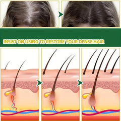 Onion Essence Hair Spray 7 Days Hair Essential Onion Hair Care Serum