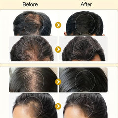 Onion Essence Hair Spray 7 Days Hair Essential Onion Hair Care Serum