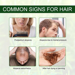 Rosemary Mint Scalp & Hair Strengthening with Biotin - Repair Split Ends