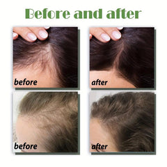 Men's Hair Dense Essential Serum Natural Plant Ingredients
