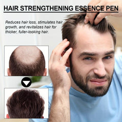 Hair Essence Pen Massage Scalp Care Strengthens Hair Healthy Hair