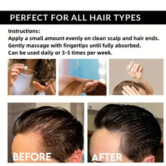 100% Pure Ginger Essential Spray for All Hair Types