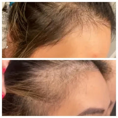 100% Pure Ginger Essential Spray for All Hair Types