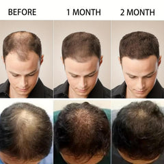 Ginger Hair Care Essential Serum for Healthier Hair in 7 Days