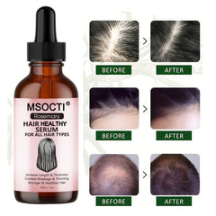 30ml Rosemary Hair Serum For All Hair Types