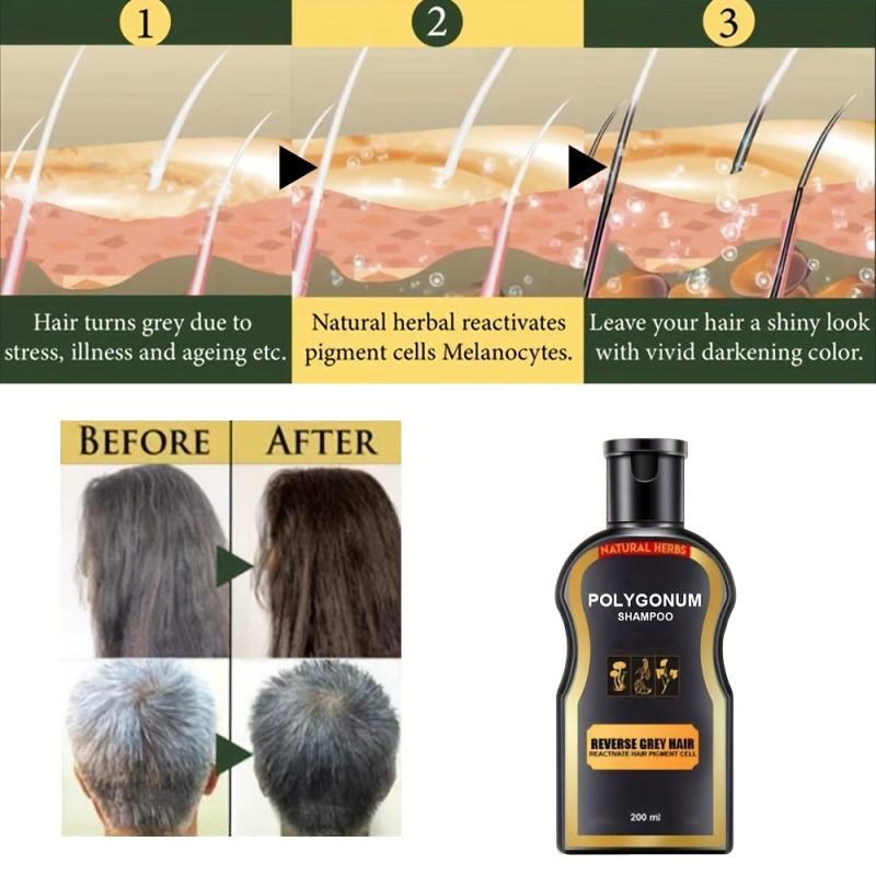 200ml 400ml Polygonum Shampoo Hair Care Shampoo Natural Hair Shampoo