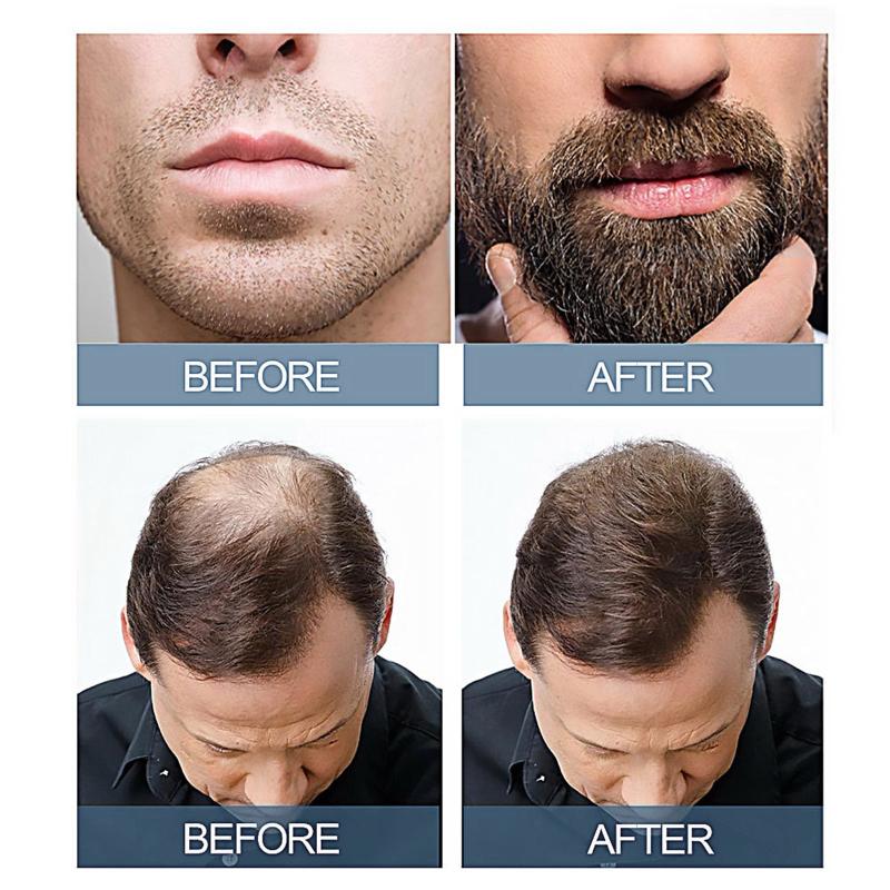 Herbal Hair Essence Massage Scalp & Hair Root Beard Care Essence