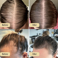 Natural Rosemary & Mint Hair Essential Infused With Biotin