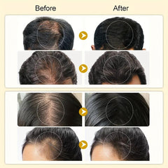 Polygonum Multiflorum Hair Serum Healthy Hair Root to Tip