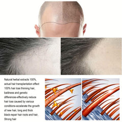 30ml Ginger Extract Hair Essence Spray - Strengthens & Revitalizes Hair